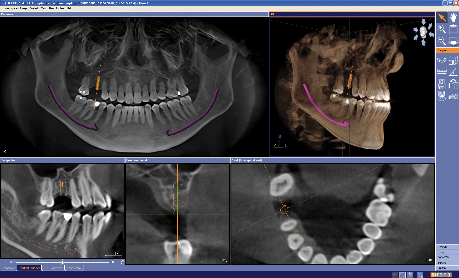 GALILEOS Software Dental Technology Used By Dentist Near Norman OK